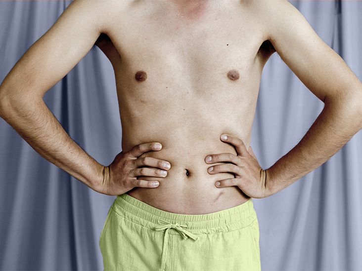 Diabète de type 2 lié à un risque plus élevé de cancer colorectal
