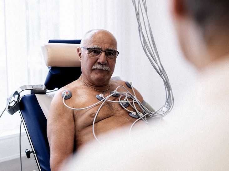 Fibrillation auriculaire : développer une fibrillation auriculaire avant 65 ans peut augmenter le risque de démence