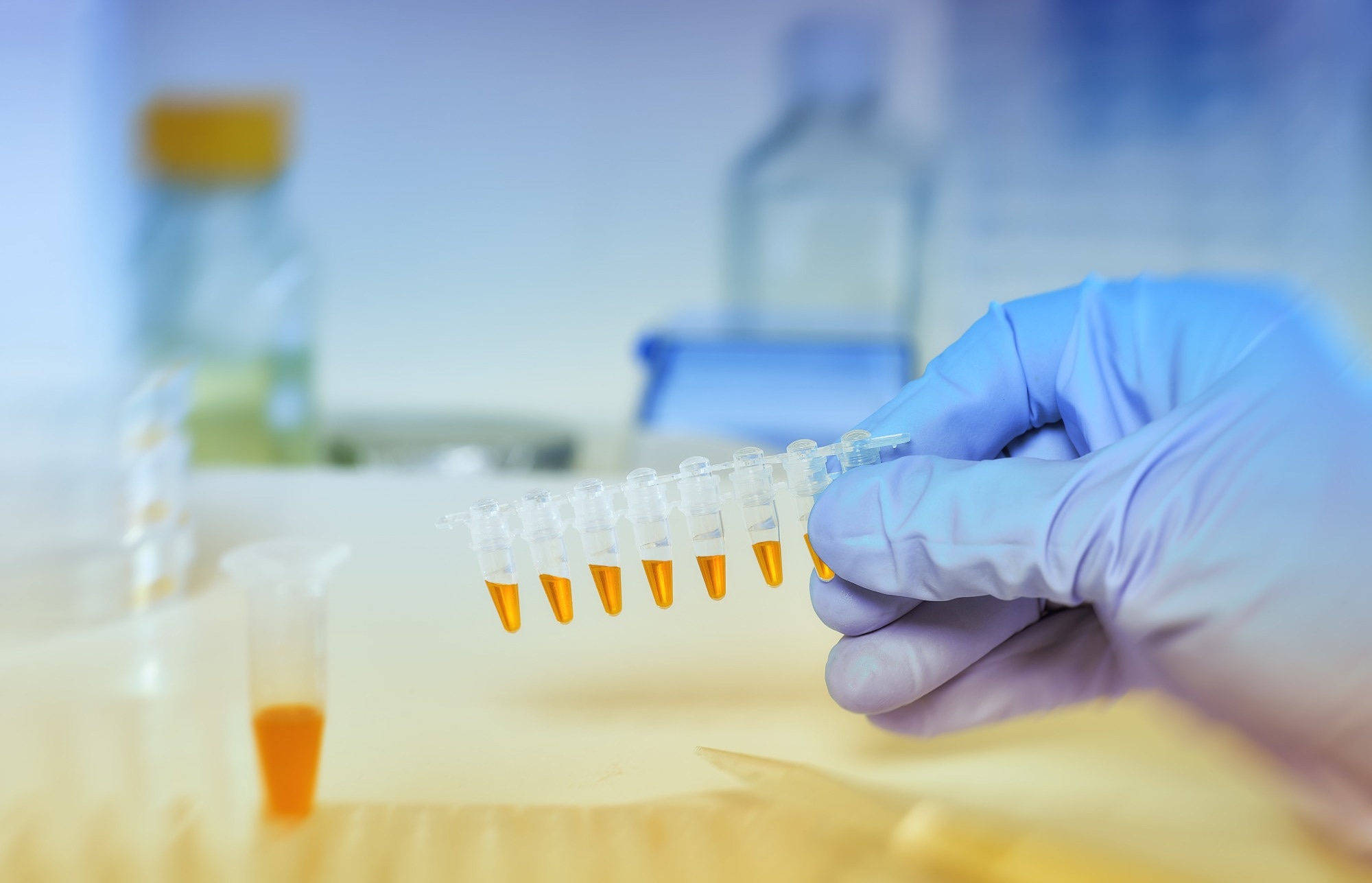 Study: Complement dysregulation is a predictive and therapeutically amenable feature of long COVID. Image Credit: tilialucida / Shutterstock