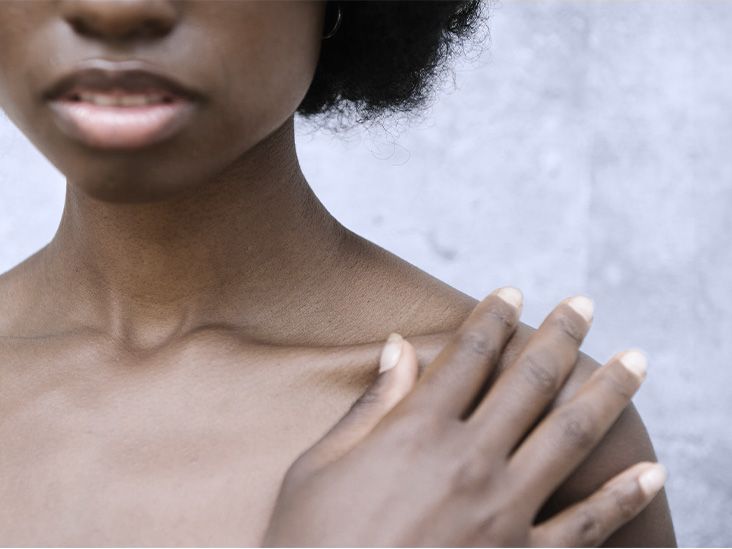 La vitamine B12 pourrait stimuler la réparation des tissus et aider à traiter la colite ulcéreuse