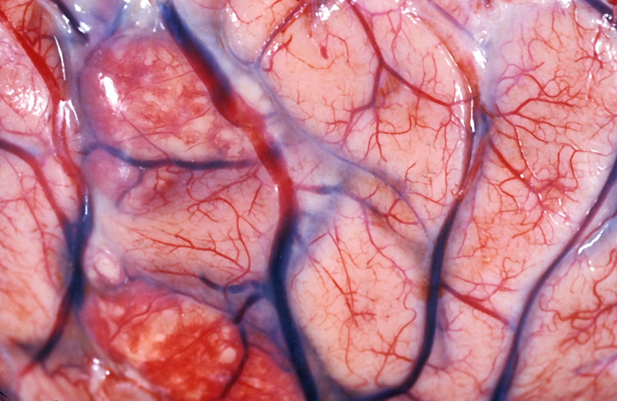 Study: Senolytic therapy alleviates physiological human brain aging and COVID-19 neuropathology. Image Credit: Jose Luis Calvo / Shutterstock