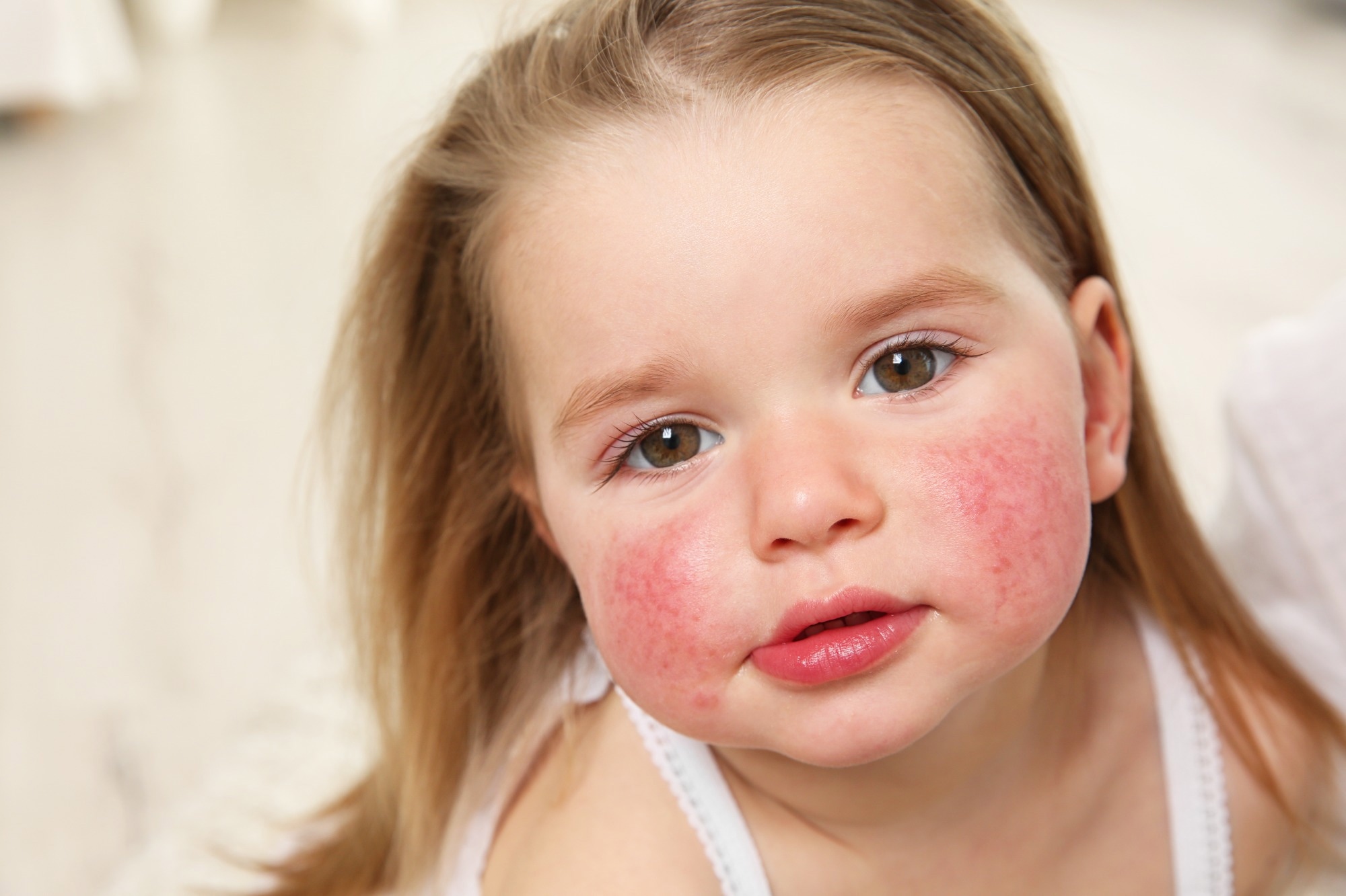 Review article: Elimination diet in food allergy: friend or foe? Image Credit: Africa Studio / Shutterstock