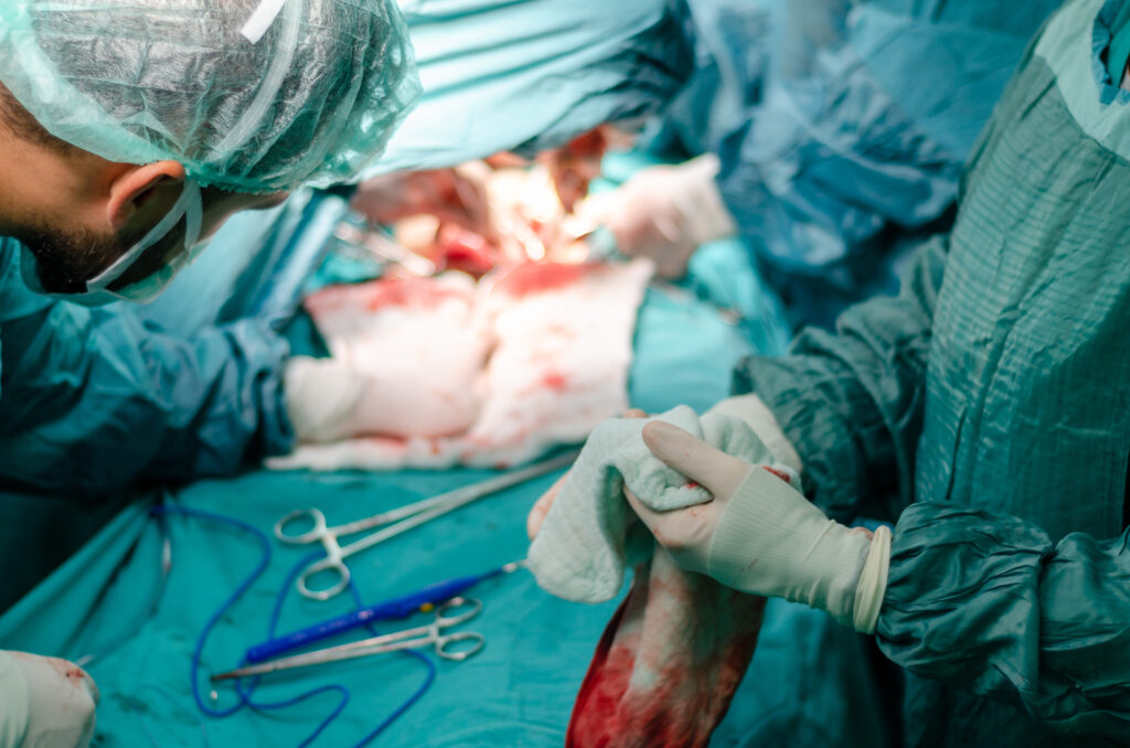 Pourquoi faire une chirurgie à l’étranger ?
