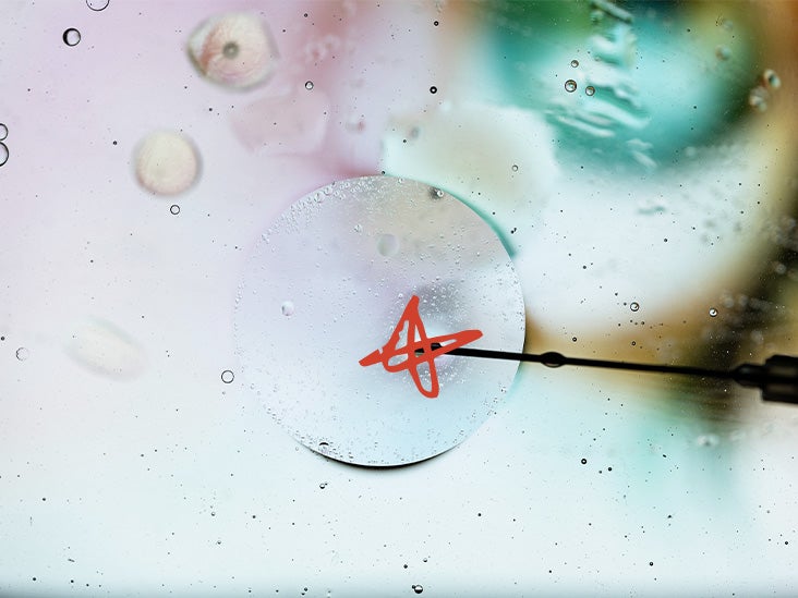 Un type spécifique de cellules souches pourrait-il aider à traiter l’arthrose ?