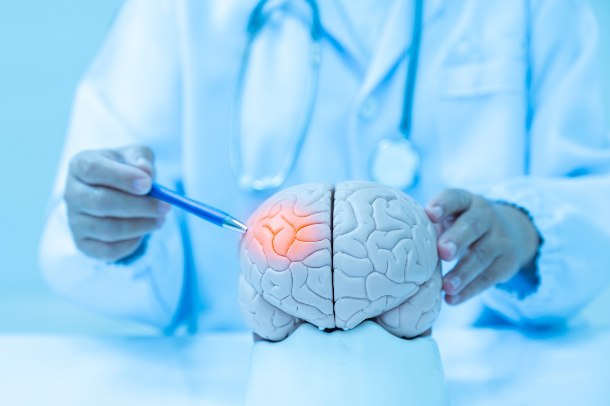 Study: Exploring the causal relationship between inflammatory cytokines and migraine: a bidirectional, two-sample Mendelian randomization study. Image Credit: Komsan Loonprom/Shutterstock.com