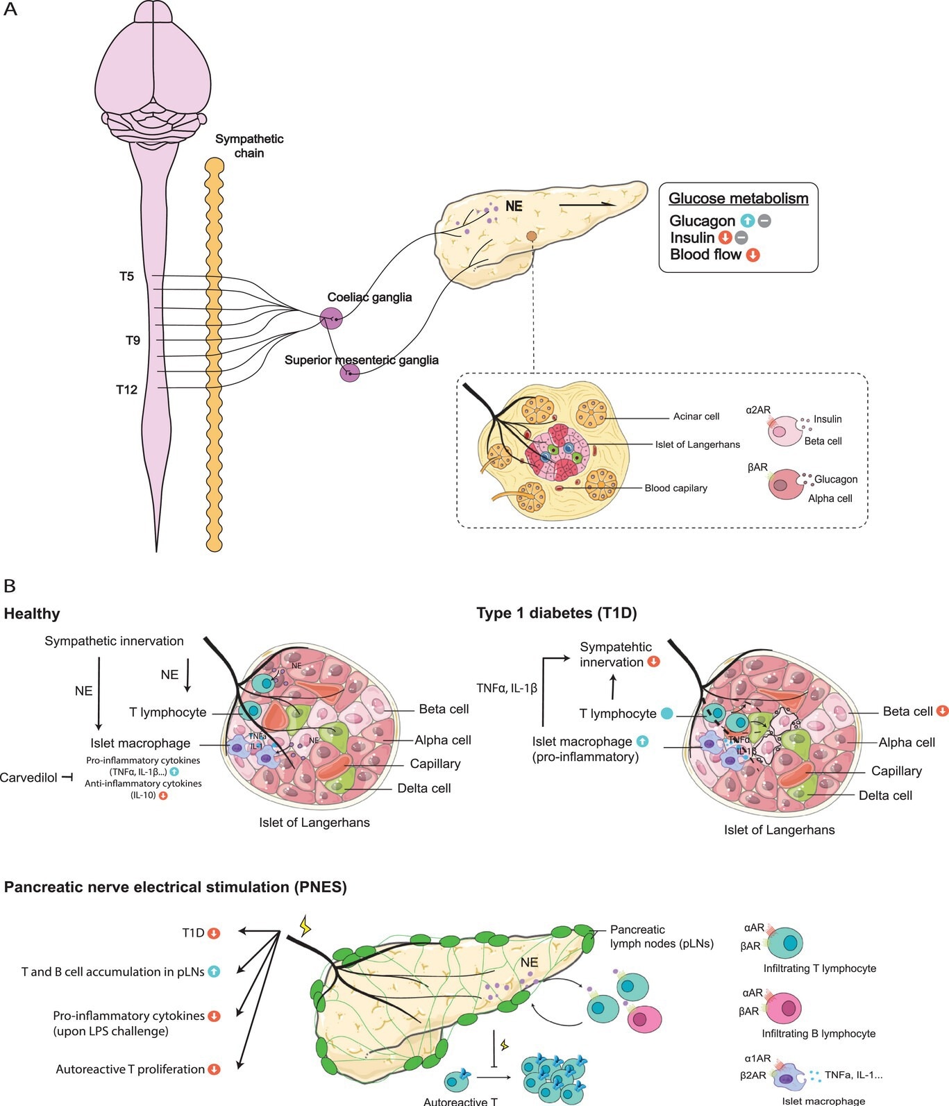 L'innervation sympathique et le milieu immunitaire du pancréas. A) Le pancréas reçoit des fibres préganglionnaires sympathiques de T5 à T12 de la moelle épinière, tandis que les fibres postganglionnaires proviennent principalement des ganglions coeliaques et des ganglions mésentériques supérieurs. Les nerfs sympathiques se projettent vers divers compartiments de l'organe, régulant le métabolisme du glucose du pancréas. B) La diaphonie sympathique-immunitaire dans les environnements sains et malades du pancréas. Le pancréas héberge des macrophages résidents et des lymphocytes T à l'état d'équilibre, dont le nombre augmente dans le diabète de type 1 (DT1), entraînant une perte de l'innervation sympathique et des lésions des cellules β pancréatiques. Il a été rapporté que la stimulation électrique du nerf pancréatique (PNES) réduit l'incidence du DT1, inhibe les états pro-inflammatoires suite à la stimulation du LPS et prévient la prolifération des lymphocytes T autoréactifs dans les ganglions lymphatiques du pancréas (pLN).