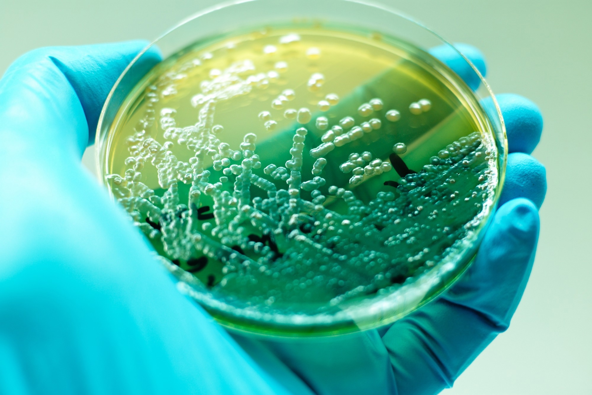Study: Prospects and possibilities of using Raman spectroscopy for the identification of Pseudomonas aeruginosa from turtle Emys orbicularis (Linnaeus, 1758) skin. Image Credit: Jun MT / Shutterstock