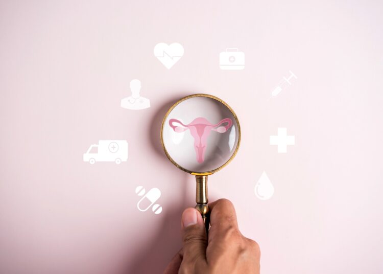 Study: Moving beyond Weight: A Narrative Review of the Dietary and Lifestyle Management for Reducing Cardiometabolic Risk in Polycystic Ovary Syndrome (PCOS). Image Credit: MMD Creative/Shutterstock.com