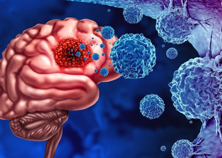 Study: Association between viral infections and glioma risk: a two-sample bidirectional Mendelian randomization analysis. Image Credit: Lightspring/Shutterstock.com