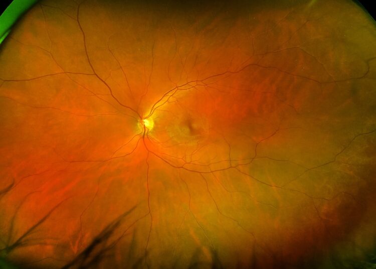Study: Development of Deep Ensembles to Screen for Autism and Symptom Severity Using Retinal Photographs. Image Credit: yogenystocker / Shutterstock
