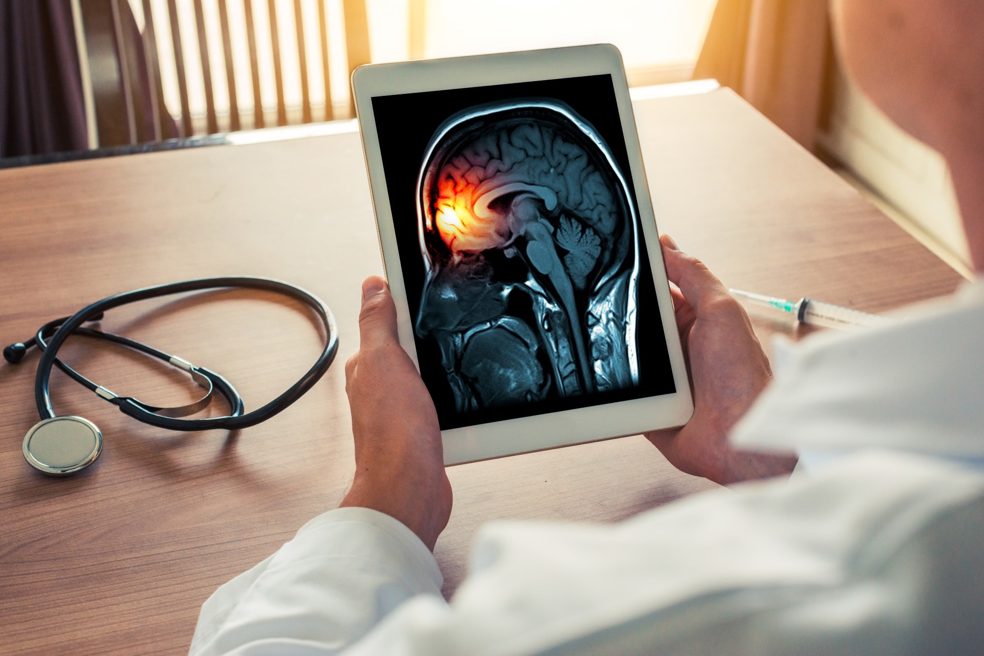 Les premiers symptômes variés de la méningite bactérienne chez les adultes et les enfants mettent en évidence les défis diagnostiques