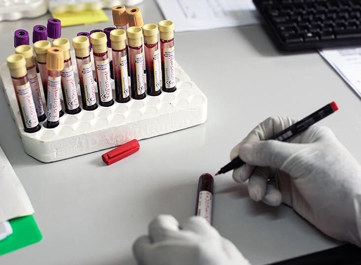 Pourquoi les cas d’infection au VIH sont-ils en augmentation chez les filles ?