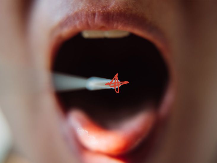Un test salivaire simple pourrait-il aider à diagnostiquer différents types de cancer à l’avenir ?