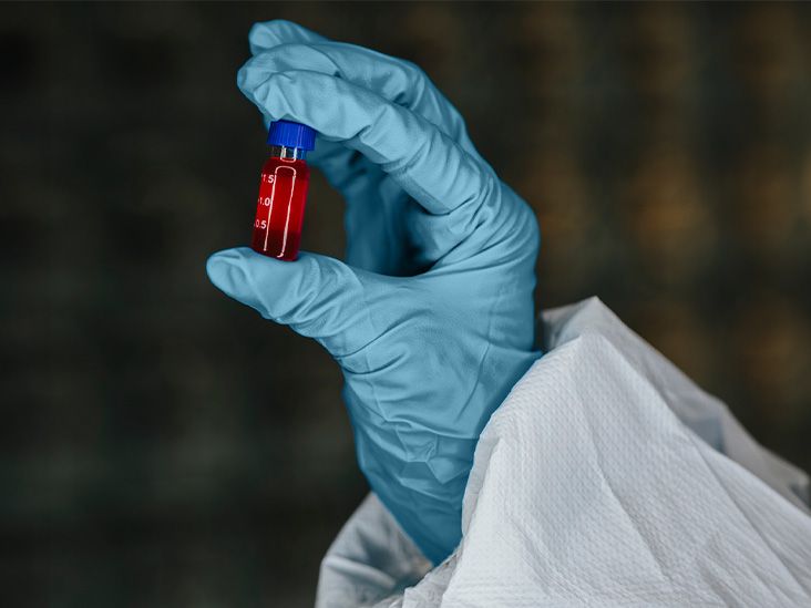Un test sanguin expérimental pourrait détecter la maladie de Parkinson avant l'apparition des symptômes