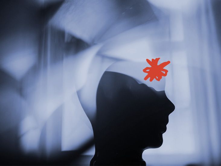 Comment une mauvaise nuit de sommeil peut déclencher des migraines