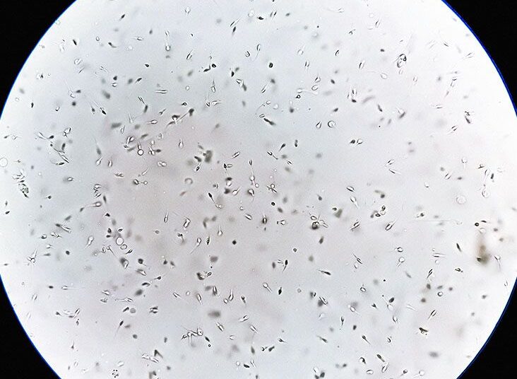 Le microbiome du sperme lié à l’infertilité masculine, selon une étude