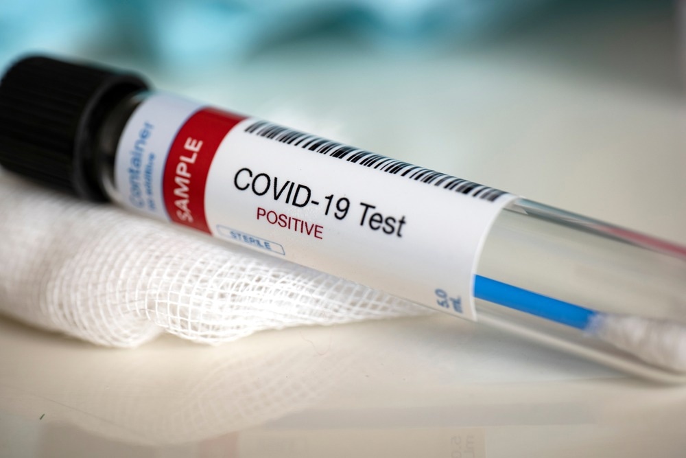 Study: Pseudo-Luciferase Activity of the SARS-CoV-2 Spike Protein for Cypridina Luciferin. Image Credit: Myriam B/Shutterstock.com