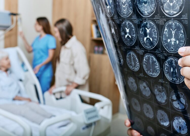 Study: Association between dietary inflammatory index and Stroke in the US population: evidence from NHANES 1999–2018. Image Credit: Peakstock/Shutterstock.com