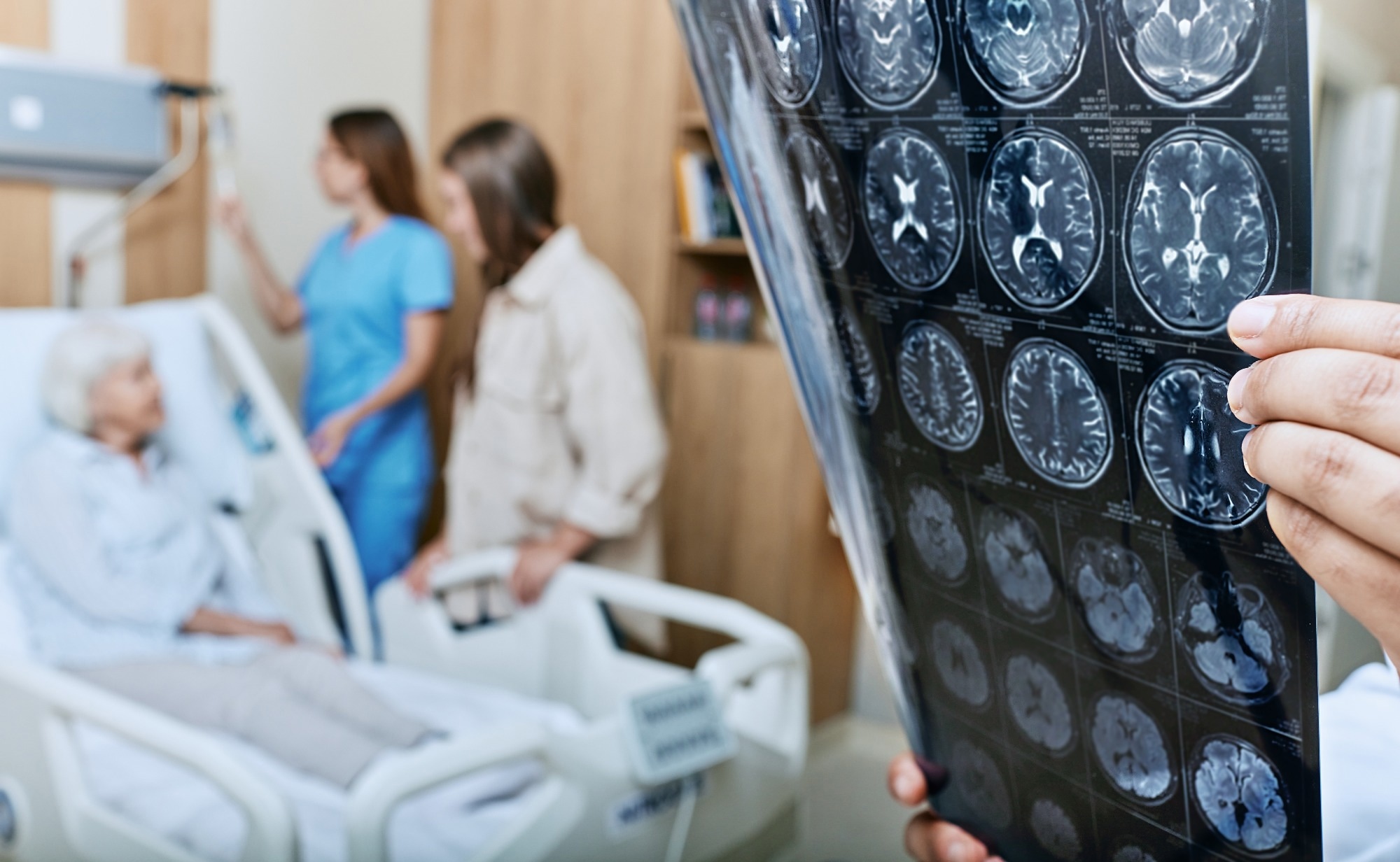 Study: Association between dietary inflammatory index and Stroke in the US population: evidence from NHANES 1999–2018. Image Credit: Peakstock/Shutterstock.com