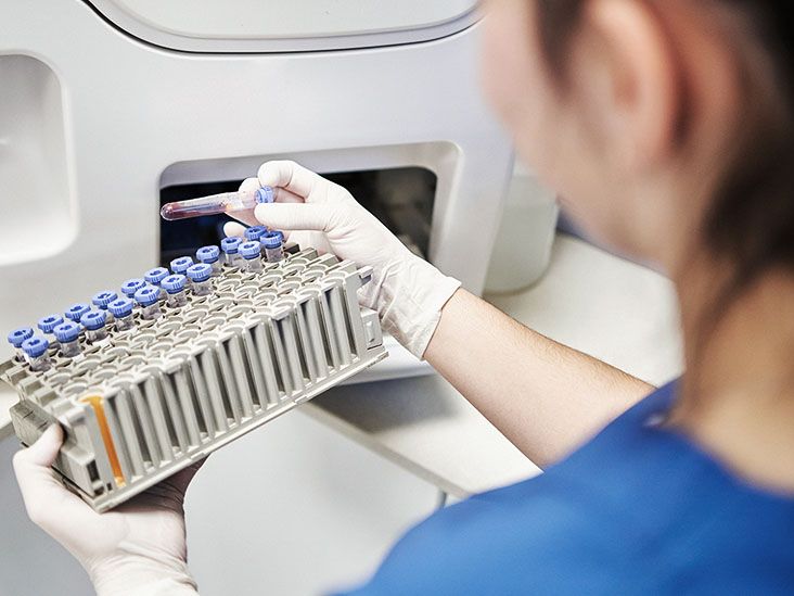L’obésité liée au cancer du sang précurseur du myélome multiple