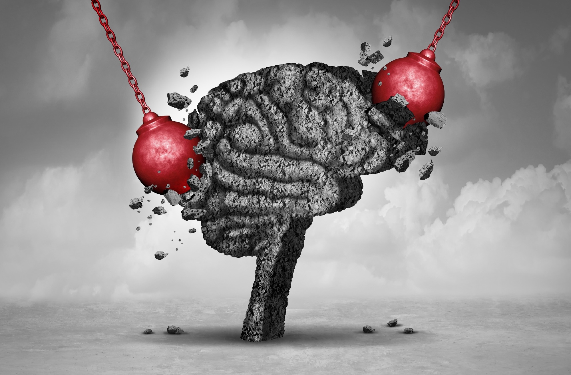 Study: Migraine is associated with the development of adult patients with inflammatory bowel disease: a nationwide, population-based study. Image Credit: Lightspring / Shutterstock