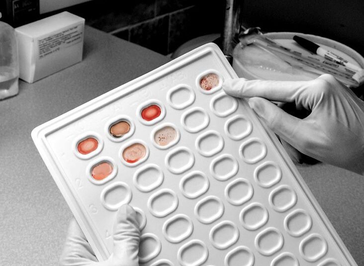 Un nouveau test sanguin prometteur pour détecter 18 types de cancer
