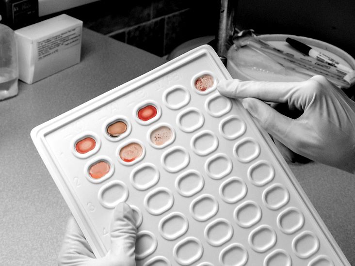 Un nouveau test sanguin prometteur pour détecter 18 types de cancer