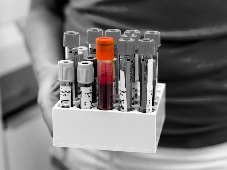 Un test sanguin pourrait détecter les premiers signes de la maladie d ...