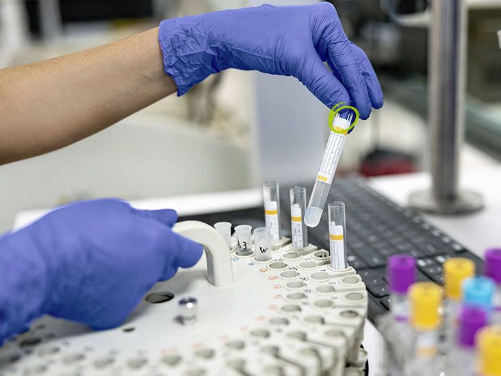 La nouvelle nanomédecine à ARN réduit la réplication du VIH de 73 %, selon une étude