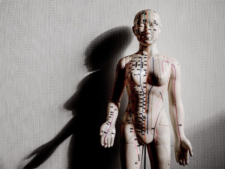 L'acupuncture peut aider à réduire le risque d'accident vasculaire cérébral chez les personnes atteintes de polyarthrite rhumatoïde