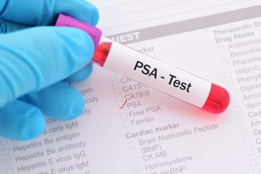Study: Prostate Cancer Screening Uptake in Transgender Women. Image Credit: Jarun Ontakrai/Shutterstock.com