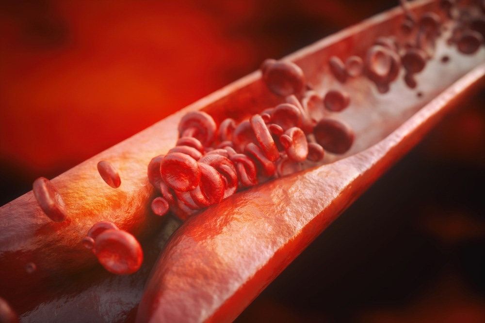 Study: Identification of a leucine-mediated threshold effect governing macrophage mTOR signalling and cardiovascular risk. Image Credit: Crevis/Shutterstock.com