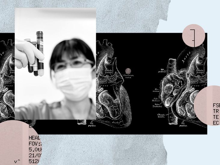 Un simple test sanguin peut permettre de prédire le risque de crise cardiaque dans les 6 mois