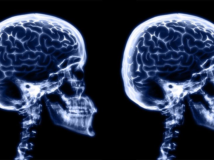 Des taux de glucose trop élevés ou trop bas peuvent ralentir la cognition chez les personnes atteintes de diabète de type 1