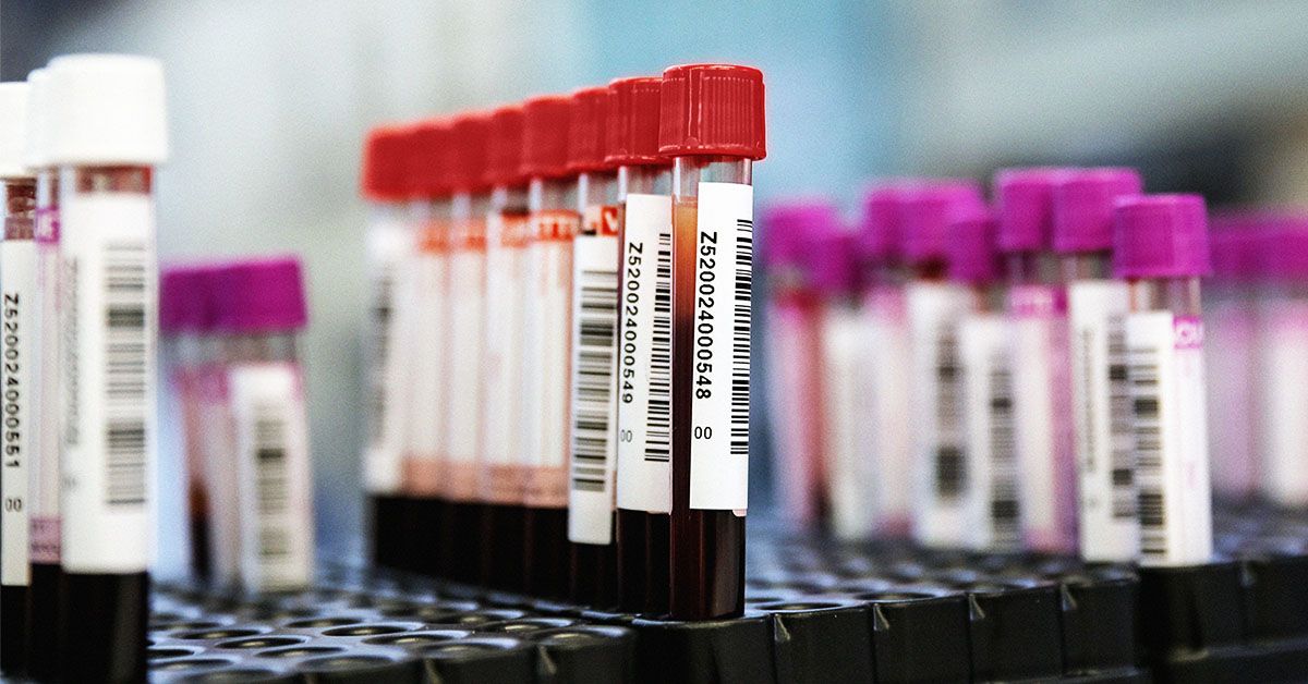 Un nouveau test sanguin semble prometteur dans la détection du cancer colorectal