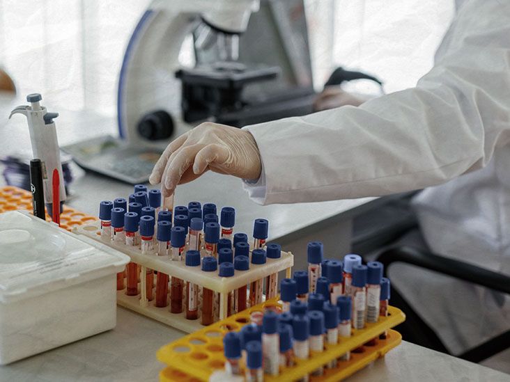 Une simple prise de sang pourrait-elle permettre de diagnostiquer la maladie d'Alzheimer ?