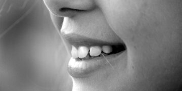 Aligner ses dents grâce aux gouttières invisibles chez Paris Dental Studios