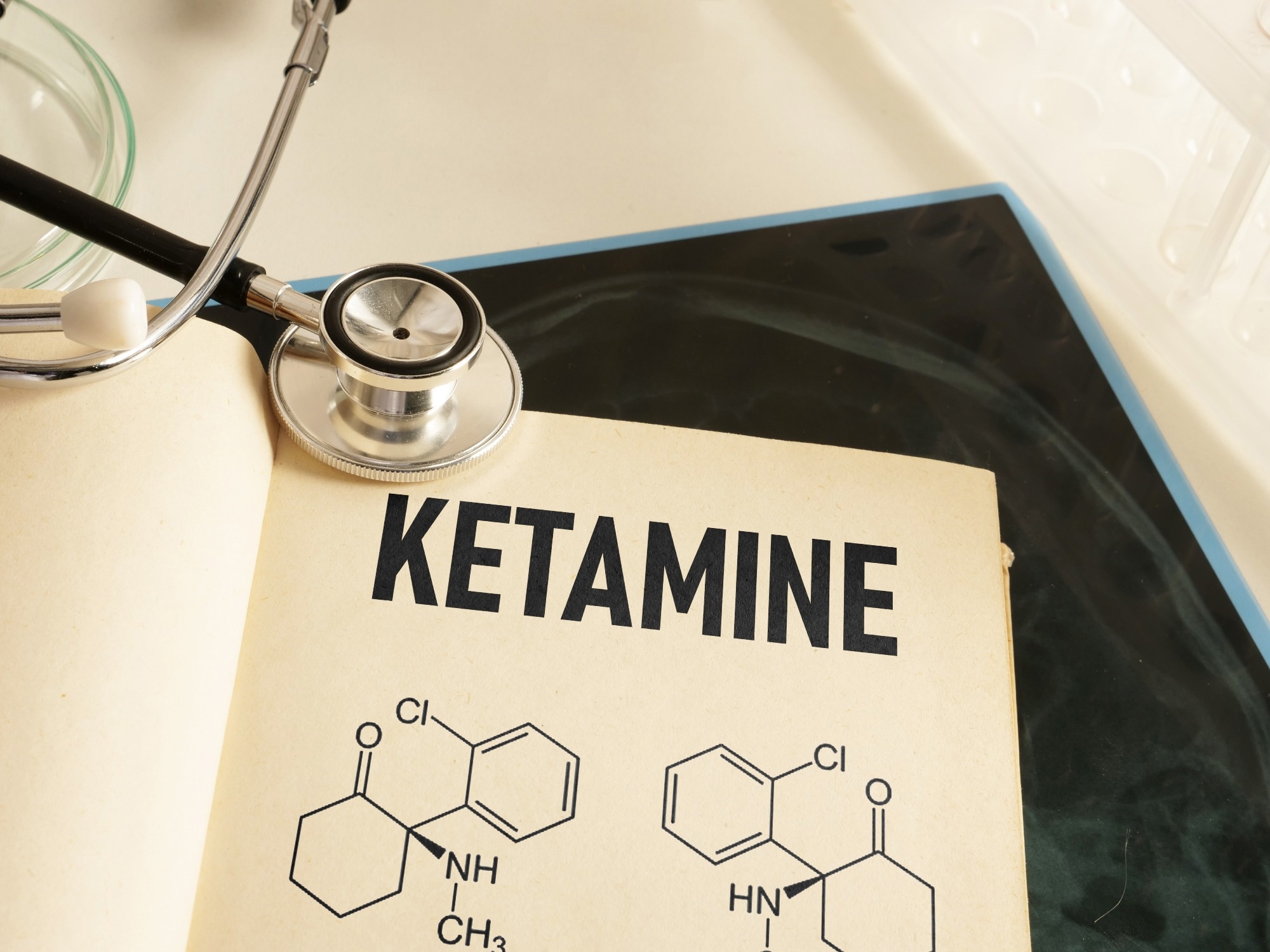 L'impact rapide de la kétamine sur la dépression est lié aux voies du système immunitaire