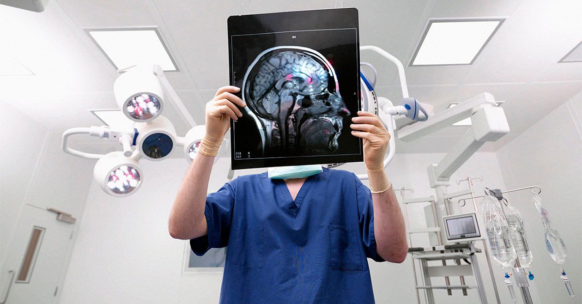 Le cerveau humain grossit : cela pourrait-il signifier une diminution du risque de démence ?