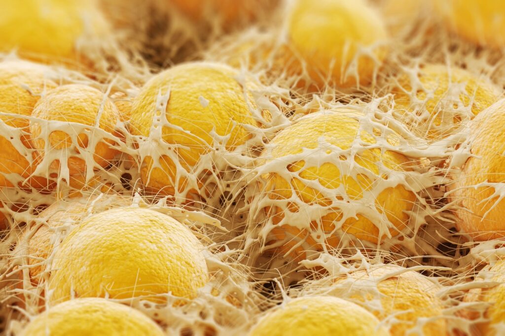Study: The Crosstalk between Gut Microbiota and White Adipose Tissue Mitochondria in Obesity. Image Credit: KateStudio / Shutterstock