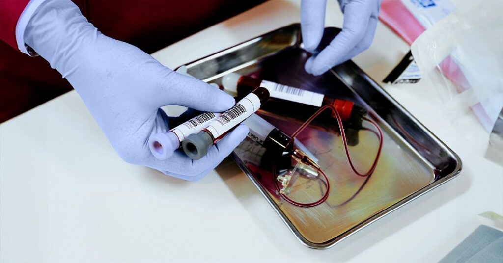 Des biomarqueurs nouvellement identifiés pourraient avertir d’un cancer 7 ans avant l’apparition des symptômes