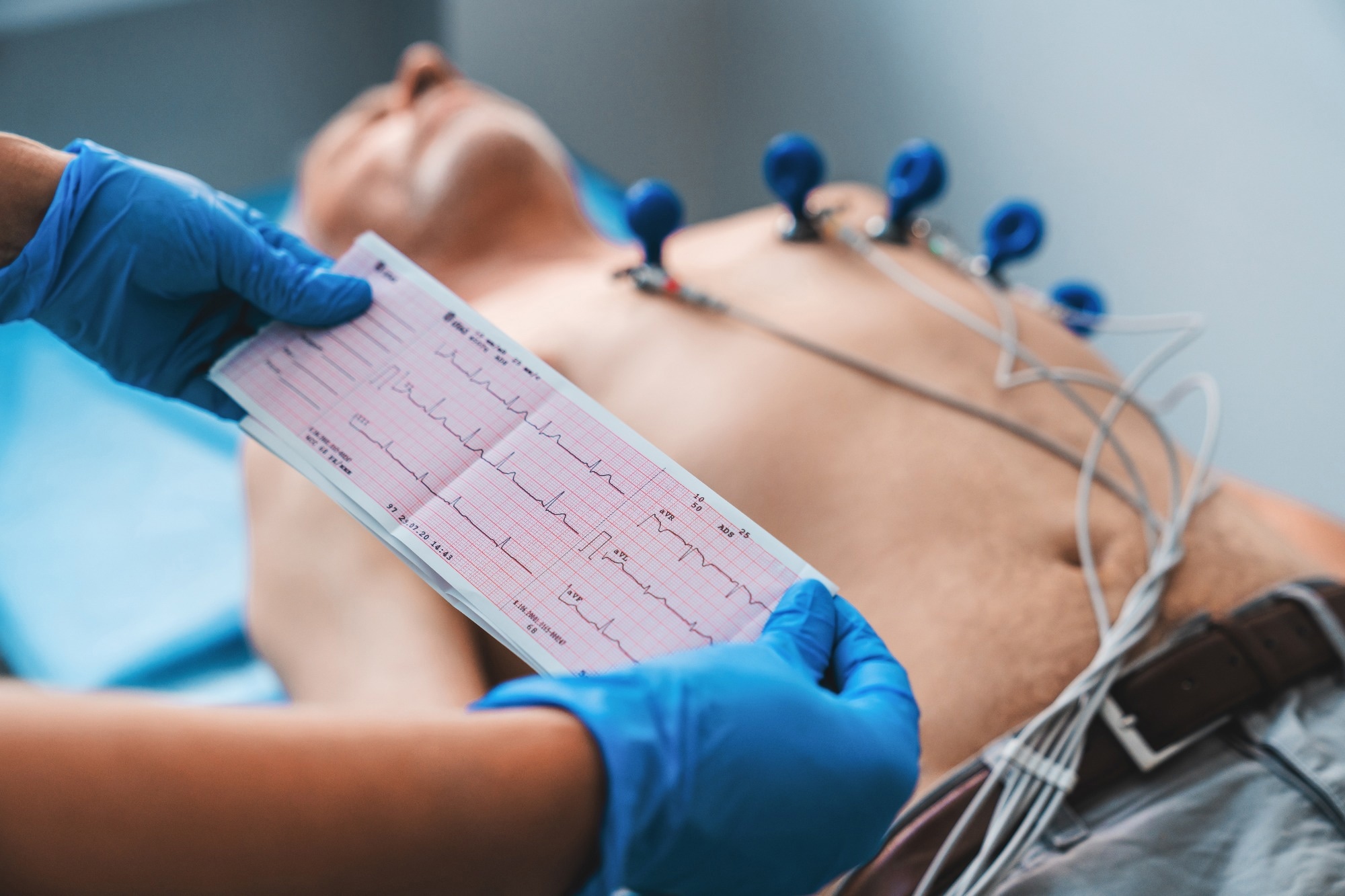 Study: The adipose-neural axis is involved in epicardial adipose tissue-related cardiac arrhythmias. Image Credit: Inside Creative House / Shutterstock