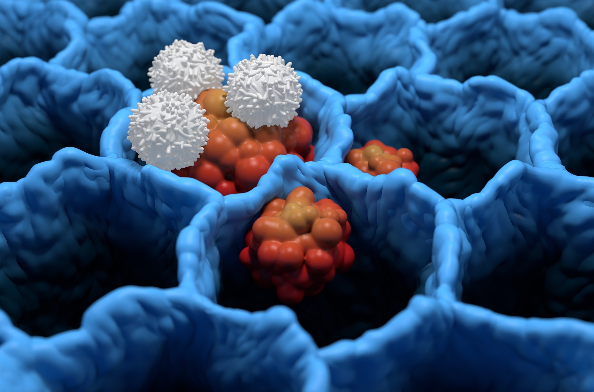 Une seule perfusion de lymphocytes T modifiés permet d'obtenir une rémission durable de l'asthme chez la souris