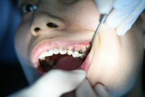 Centre dentaire à Nice : soins dentaires de qualité