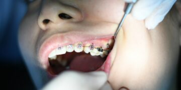 Centre dentaire à Nice : soins dentaires de qualité