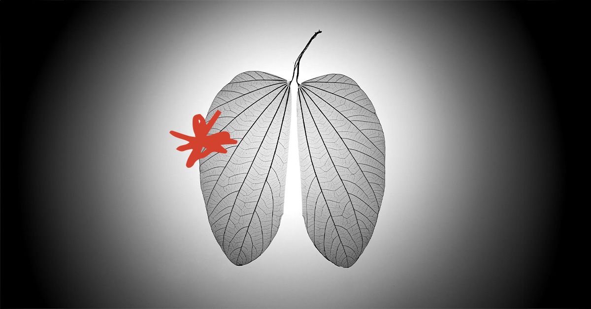 Pourquoi de nombreuses personnes atteintes d'un cancer du poumon qui n'ont jamais fumé ne réagissent pas bien aux traitements