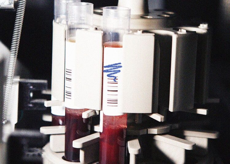 Des « signatures » protéiques dans un seul test sanguin pourraient aider à détecter plus de 60 maladies