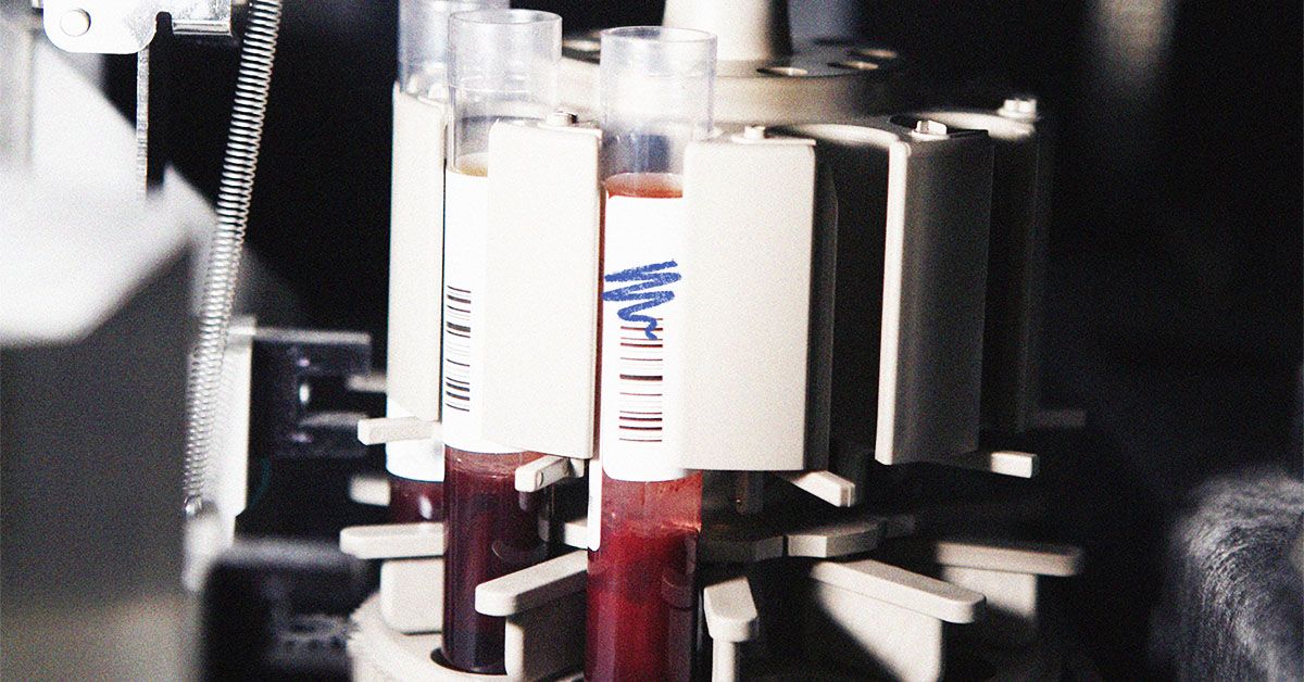 Des « signatures » protéiques dans un seul test sanguin pourraient aider à détecter plus de 60 maladies