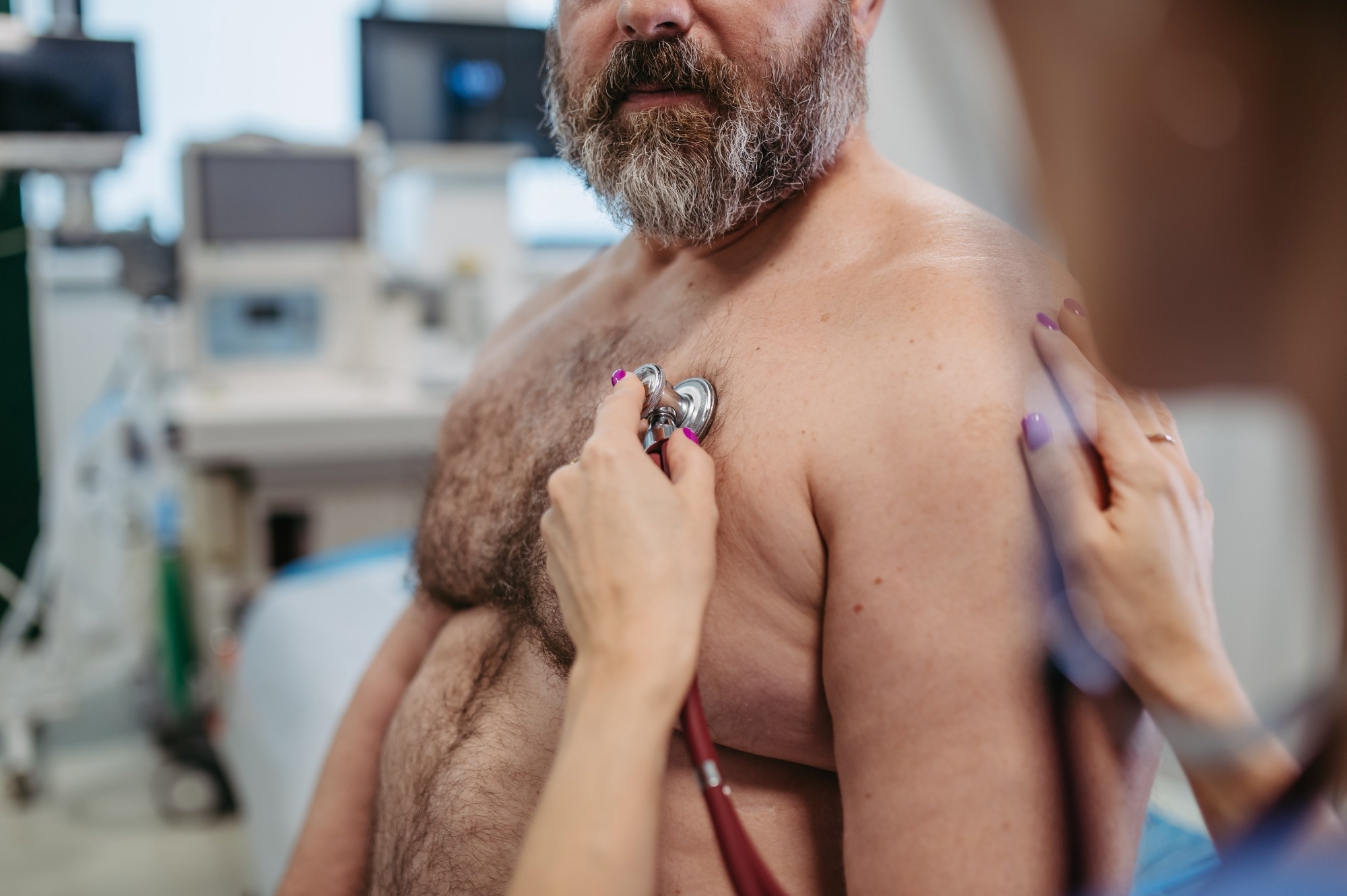 L'obésité au début de l'âge adulte est liée à des problèmes cardiaques plus tard dans la vie, selon une étude