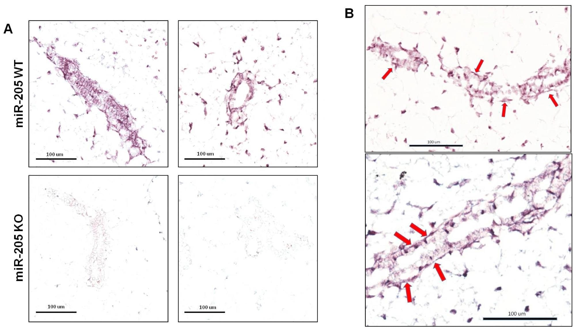 La perte génétique du miR-205 stimule le développement de la glande mammaire chez la souris et révèle de nouvelles perspectives sur la suppression du cancer du sein